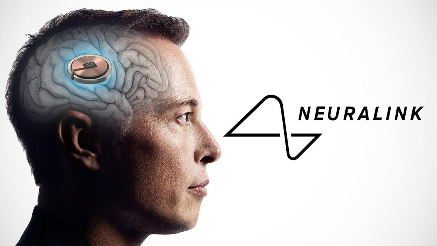 Neuralink di Elon Musk: via ai test di impianti cerebrali sull'uomo, si cercano volontari