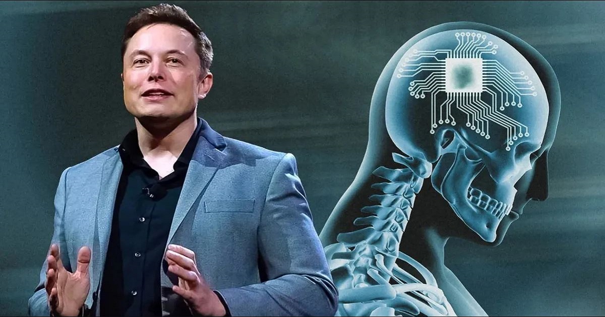Neuralink di Elon Musk: via ai test di impianti cerebrali sull'uomo, si cercano volontari